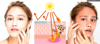 application of sunscreen