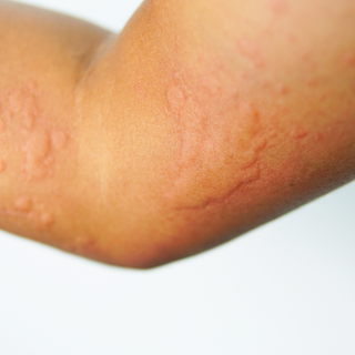 Tips For People With Sensitive Skin