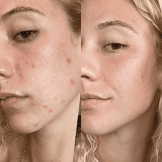 Favorite Anti-Aging Serums (4 PACK)