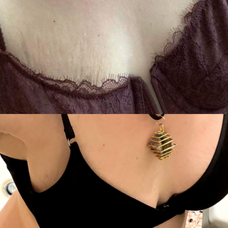 0.75mm Body Dermaroller Head Replacement - Chest Stretch Marks, Cellulite