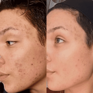 Favorite Anti-Aging Serums (4 PACK)