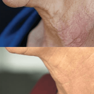 Nitric Oxide Activating Serum