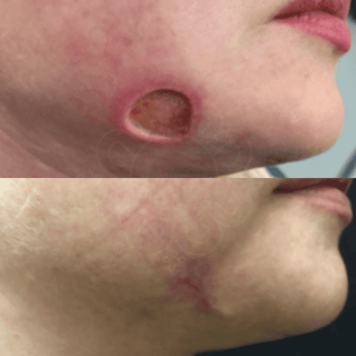 Nitric Oxide Activating Serum