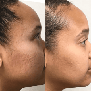 Nitric Oxide Activating Serum