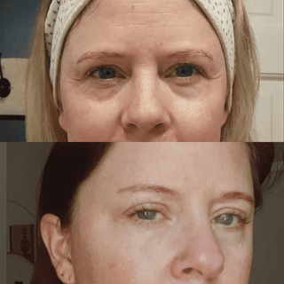 Hydration Kit - Sensitive, Dry Skin