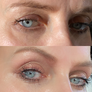 Hydra Lift Eye Masks - Dark Circles, Tired Eyes