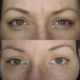 Eye Care Kit - Crow's Feet, Dark Circles, Eyebags