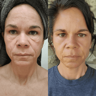 Natural Peptide Serum (Firming) - Saggy Skin, Wrinkles, Volume Loss