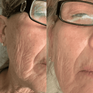 Natural Peptide Serum (Firming) - Saggy Skin, Wrinkles, Volume Loss