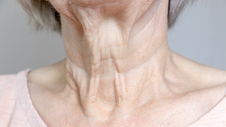 How To Get Rid Of Neck Wrinkles At Home