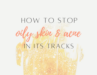 How to Stop Oily Skin & Acne in its Tracks