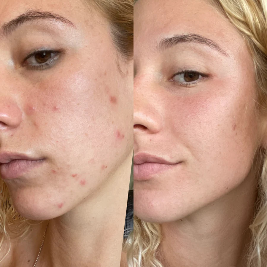 <strong>2. Over the next 24 - 48 hours: your serums go to work.</strong>