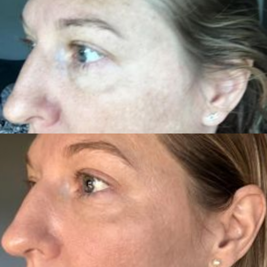 <strong>2. Over the next 24 - 48 hours: your serums go to work.</strong>