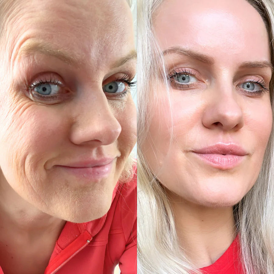 <strong>3. By week 2 - 4: texture starts to shift.</strong>