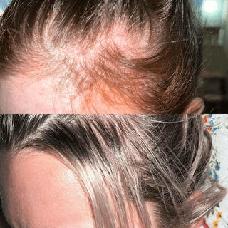 Rosemary Hair Growth Elixir - Hair Loss, Damage, Beard Growth