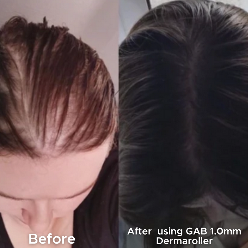 <strong>3. Most hair loss treatments for women over 40 were designed for men.</strong>