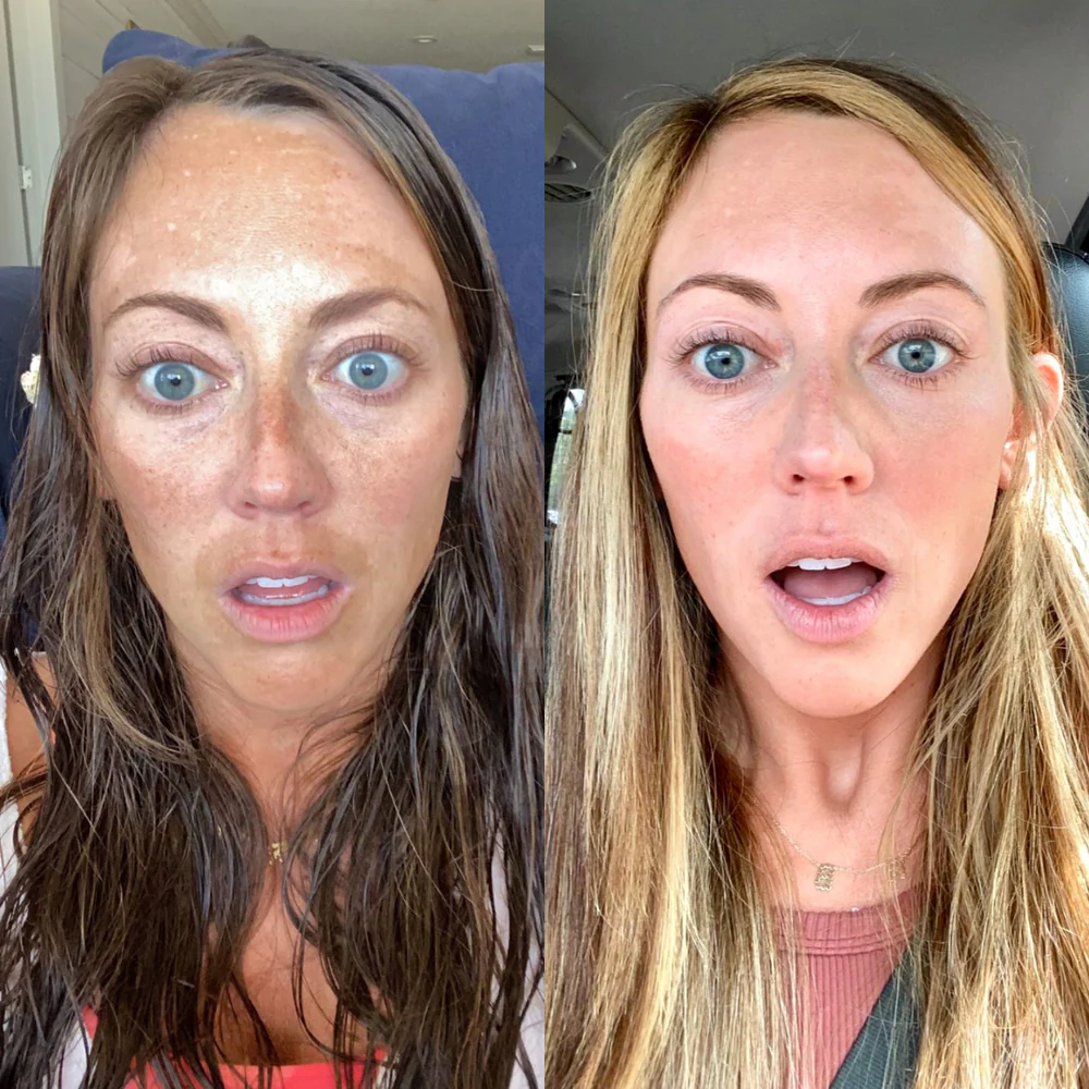 <strong>4. By month 2 - 3: the structural changes become visible.</strong>