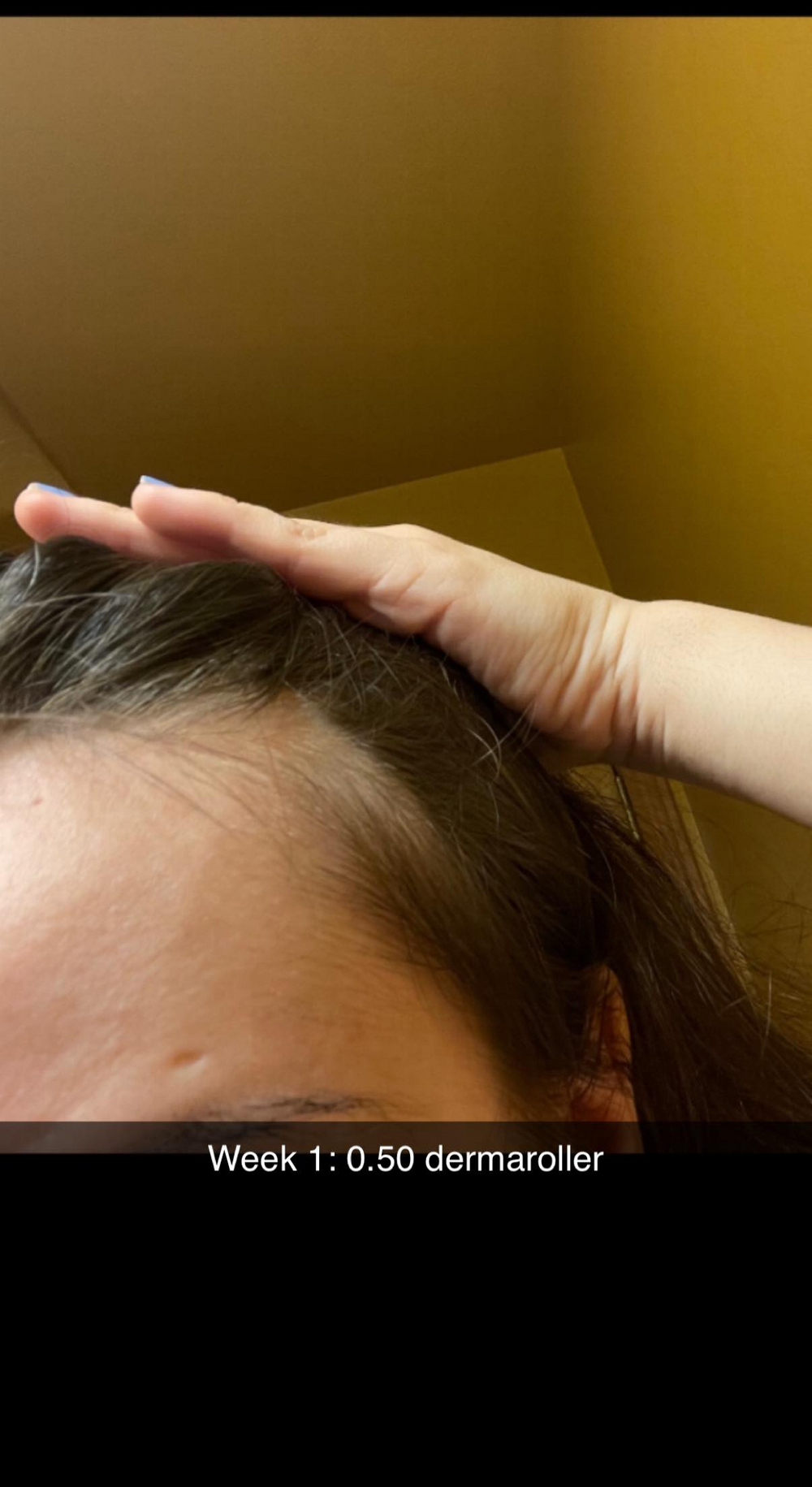 <strong>2. Your scalp has become resistant to every treatment you've tried.</strong>